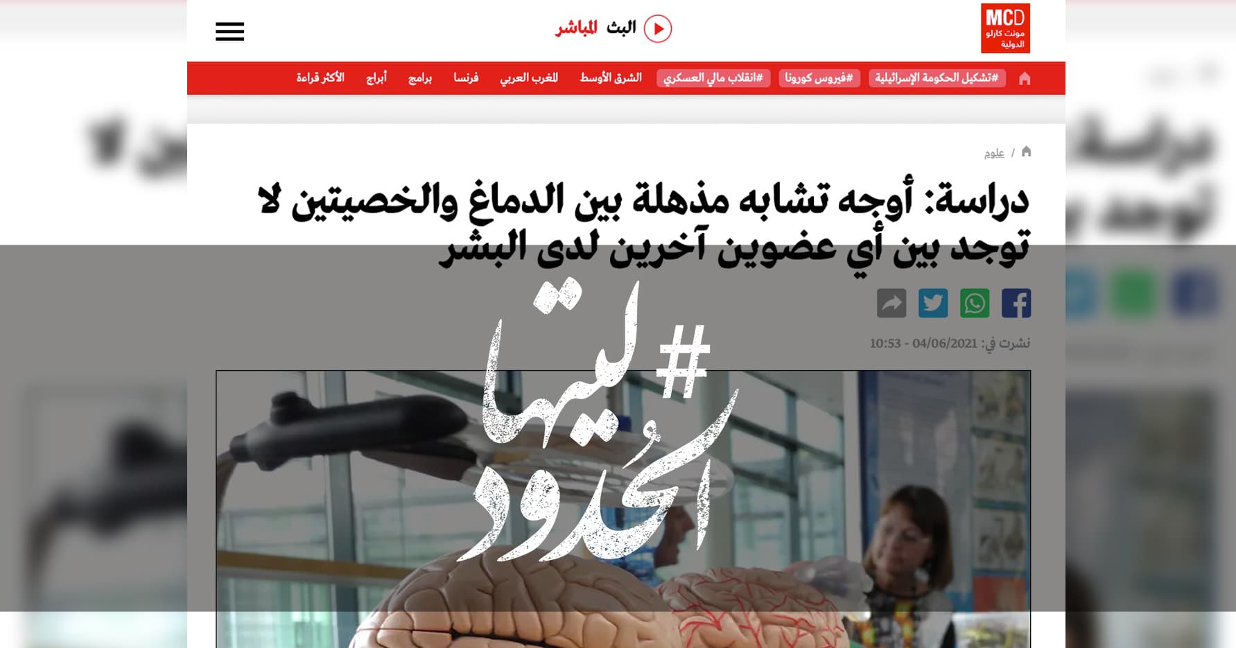 صورة دراسة: أوجه تشابه مذهلة بين الدماغ والخصيتين لا توجد بين أي عضوين آخرين لدى البشر