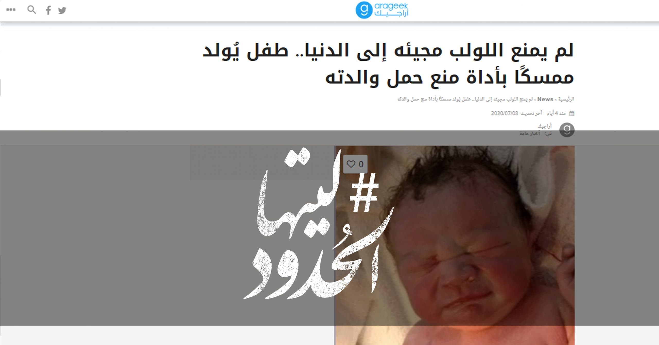 صورة لم يمنع اللولب مجيئه إلى الدنيا.. طفل يُولد ممسكًا بأداة منع حمل والدته
