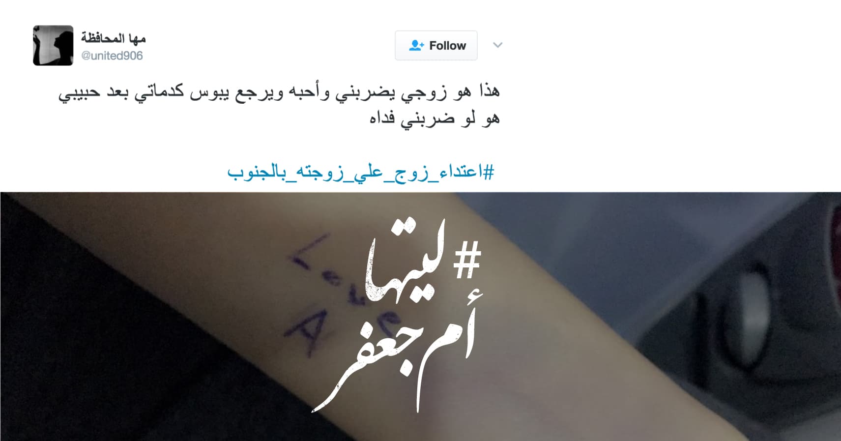 صورة زوجي حبيبي يضربني