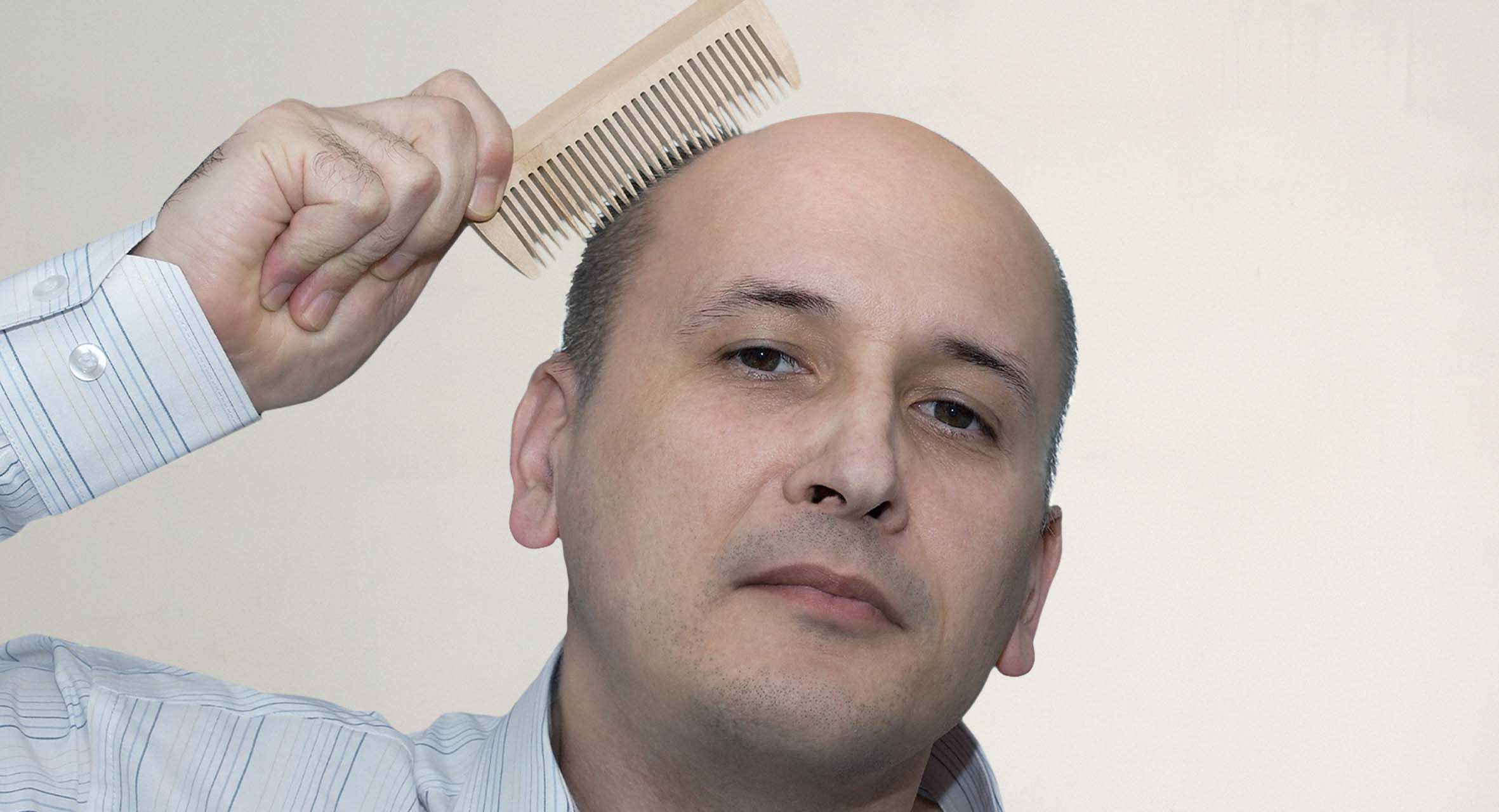 صورة كيف تحدد الوقت المناسب لحلاقة شعرك بأكمله والتصالح مع حقيقة أنك أصلع